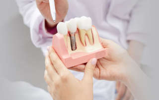 تركيبات الأسنان